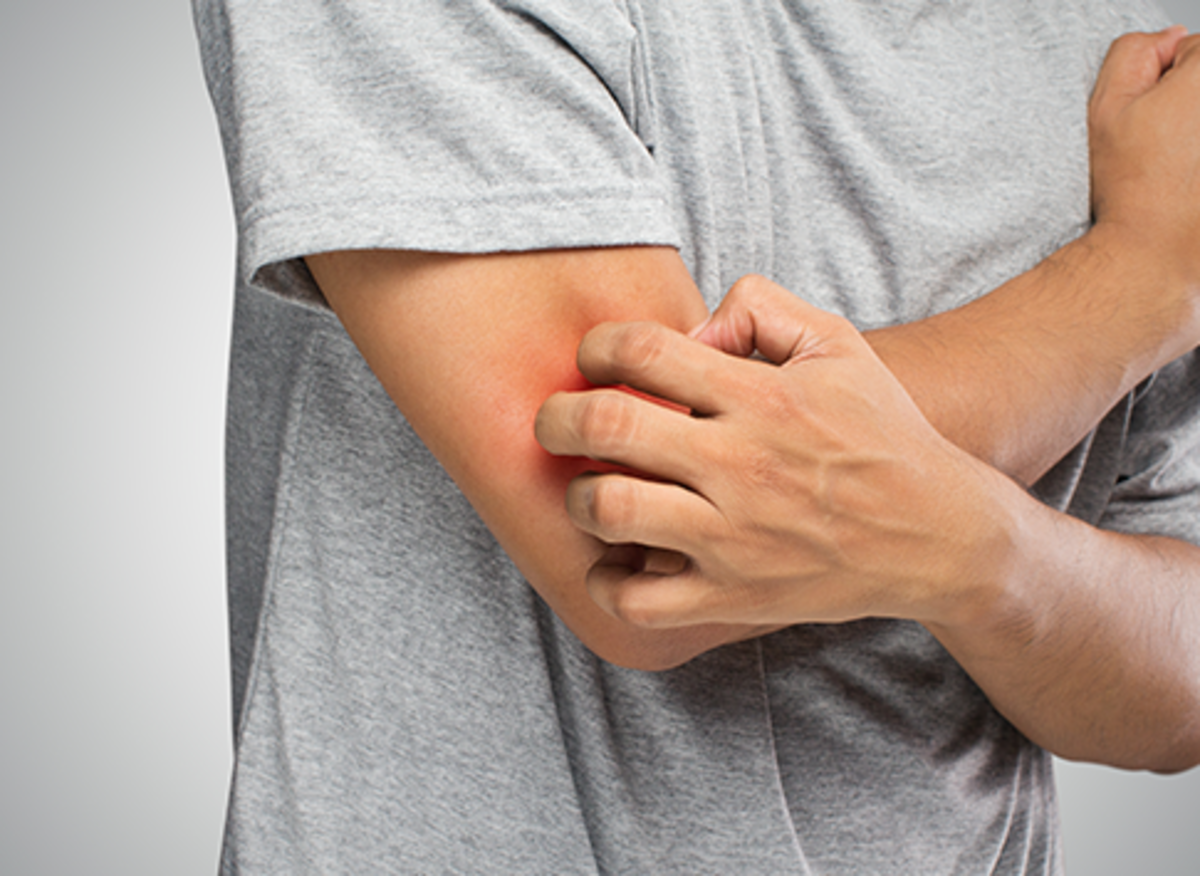 Can Lymphoma Patients Develop Itchy Skin? by Stephen Miller Medium