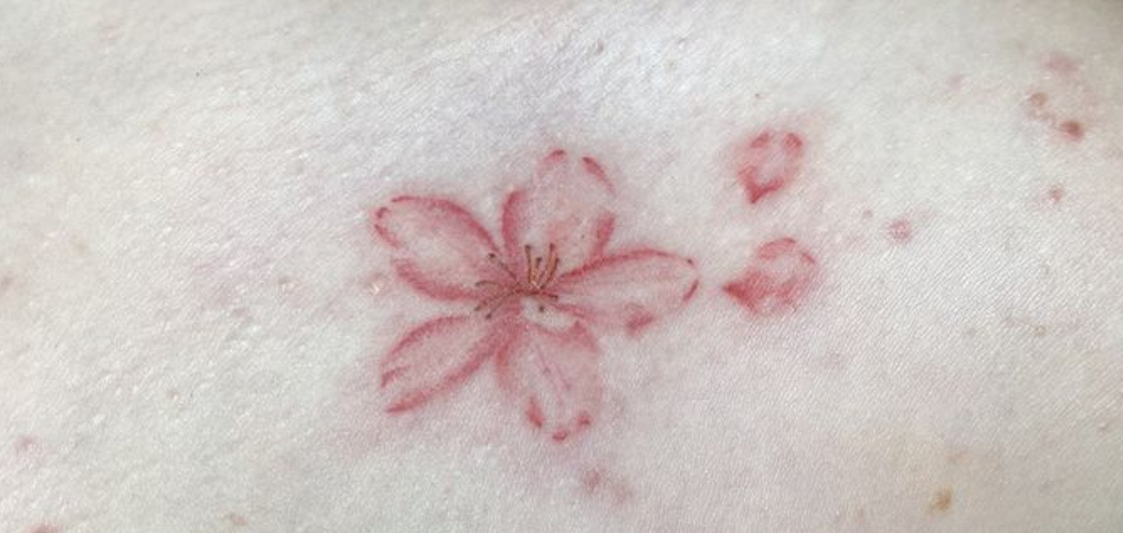 Imprinted