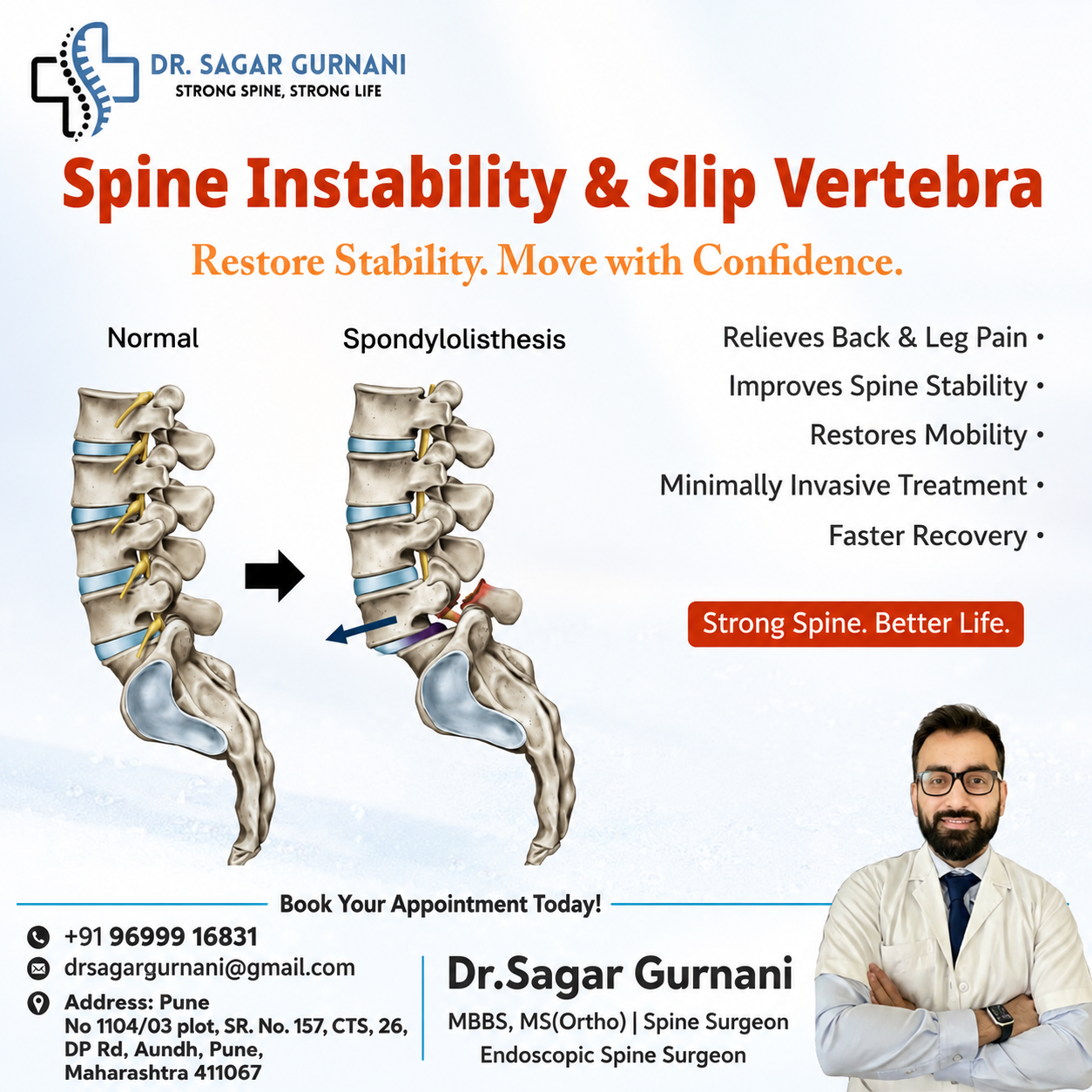 Spine Instability & Slip Vertebra: Restore Stability, Move with Confidence with the Best Spine…