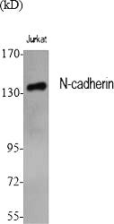 N-cadherin Polyclonal Antibody Review