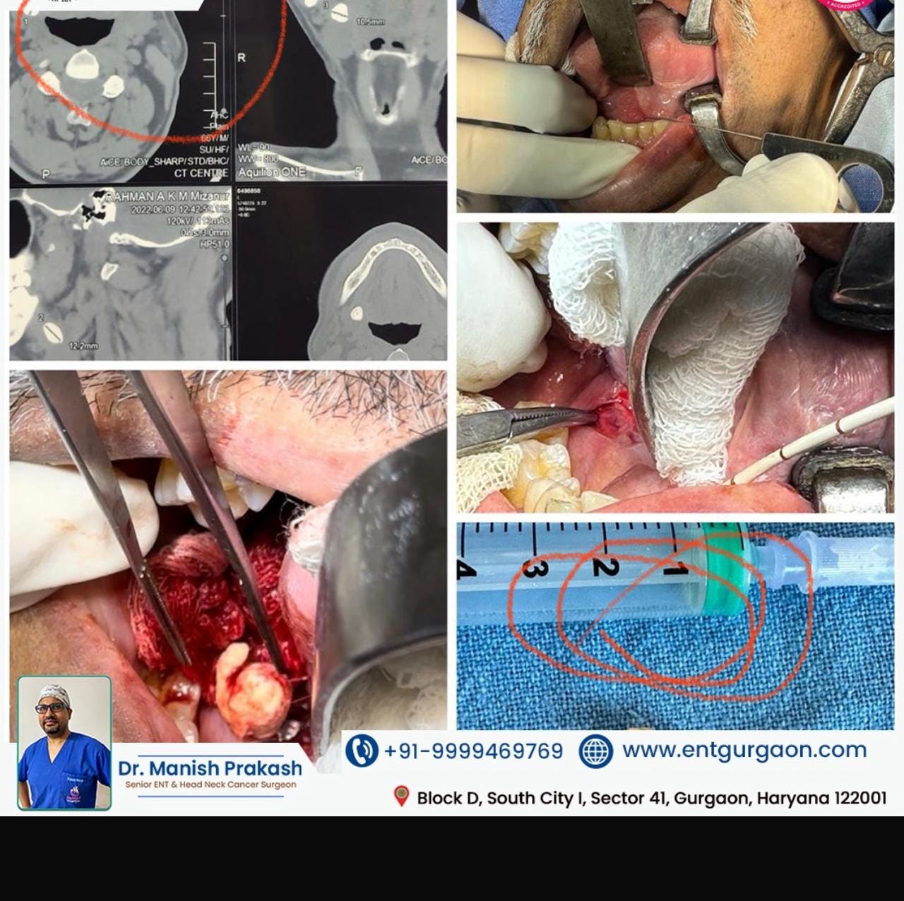 Discover the Best Radiologist in Gurgaon Your Path to Accurate Diagnostics