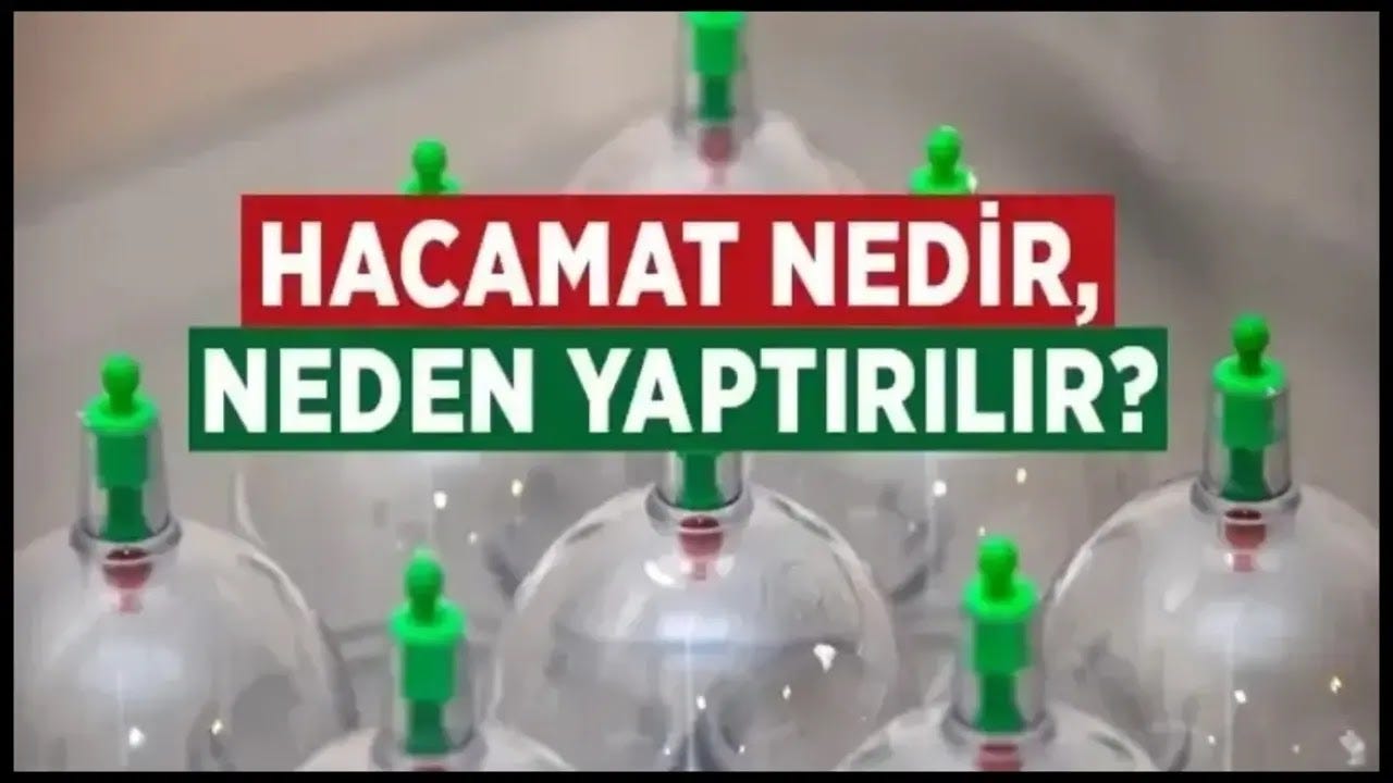 Hacamat Nedir? Hacamat Nasıl Yapılır? Hacamatın Faydaları Nelerdir? Hacamat Hakkında Tüm Bilgiler