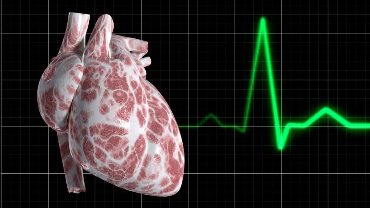 Understanding Heart Palpitations: Navigating the Discomfort of AFib-Related Fluttering and Racing…