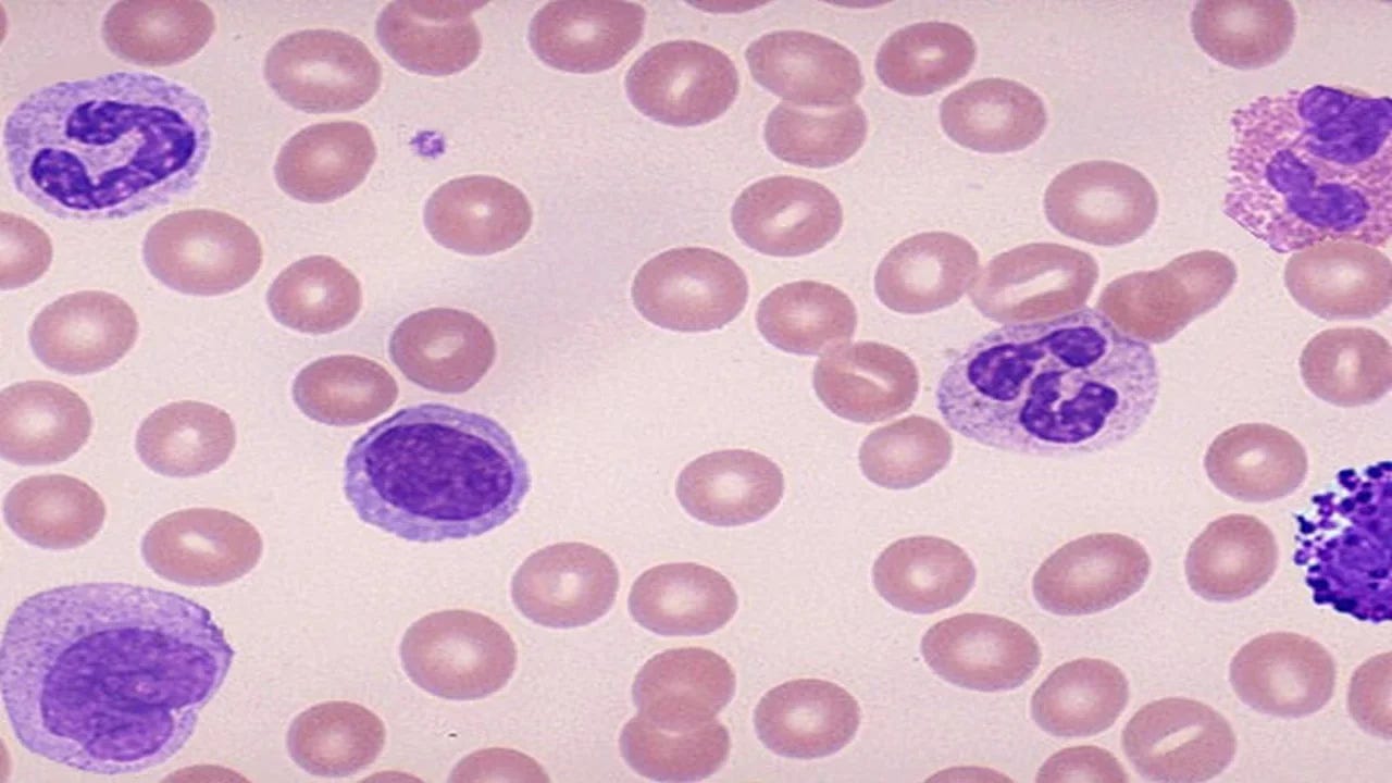 Understanding Differential Leucocyte Count: A Comprehensive Guide