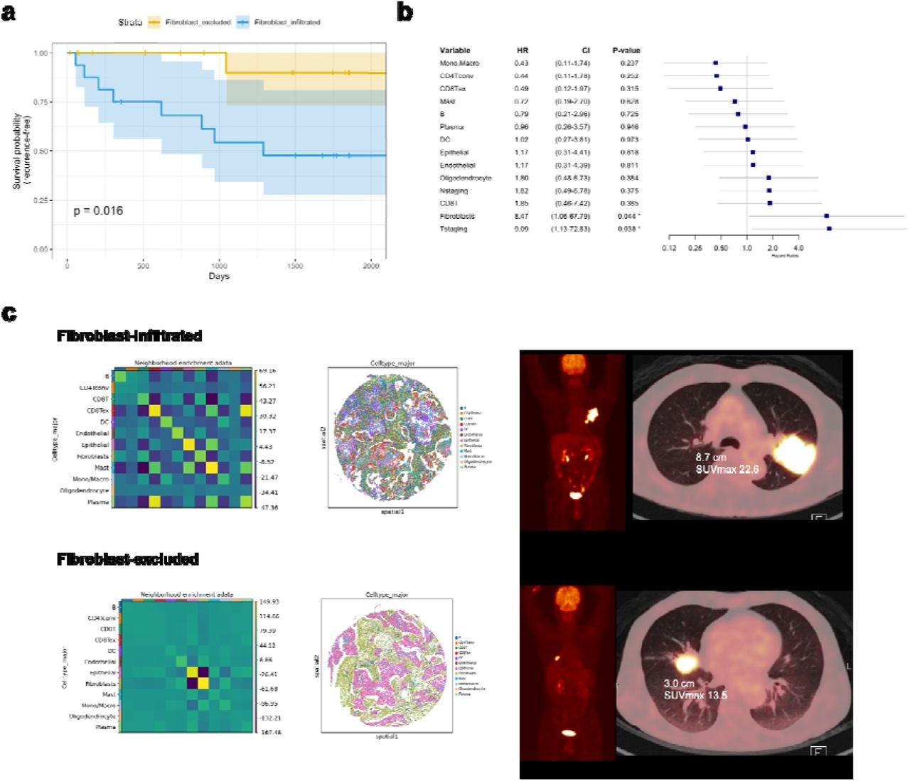 Spatial Transcriptomics Reveals Spatially Diverse Cancer-Associated Fibroblast in Lung Squamous…