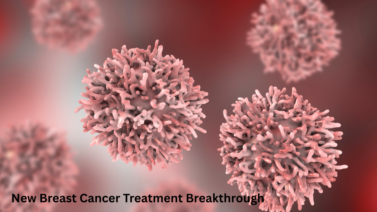 New Breast Cancer Treatment Breakthrough: A New Hope for Patients in 2026