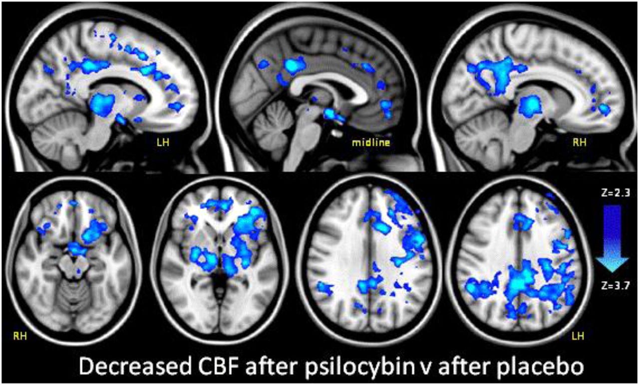 Decreased CBF after psilocybin (ASL perfusion fMRI). PNAS.