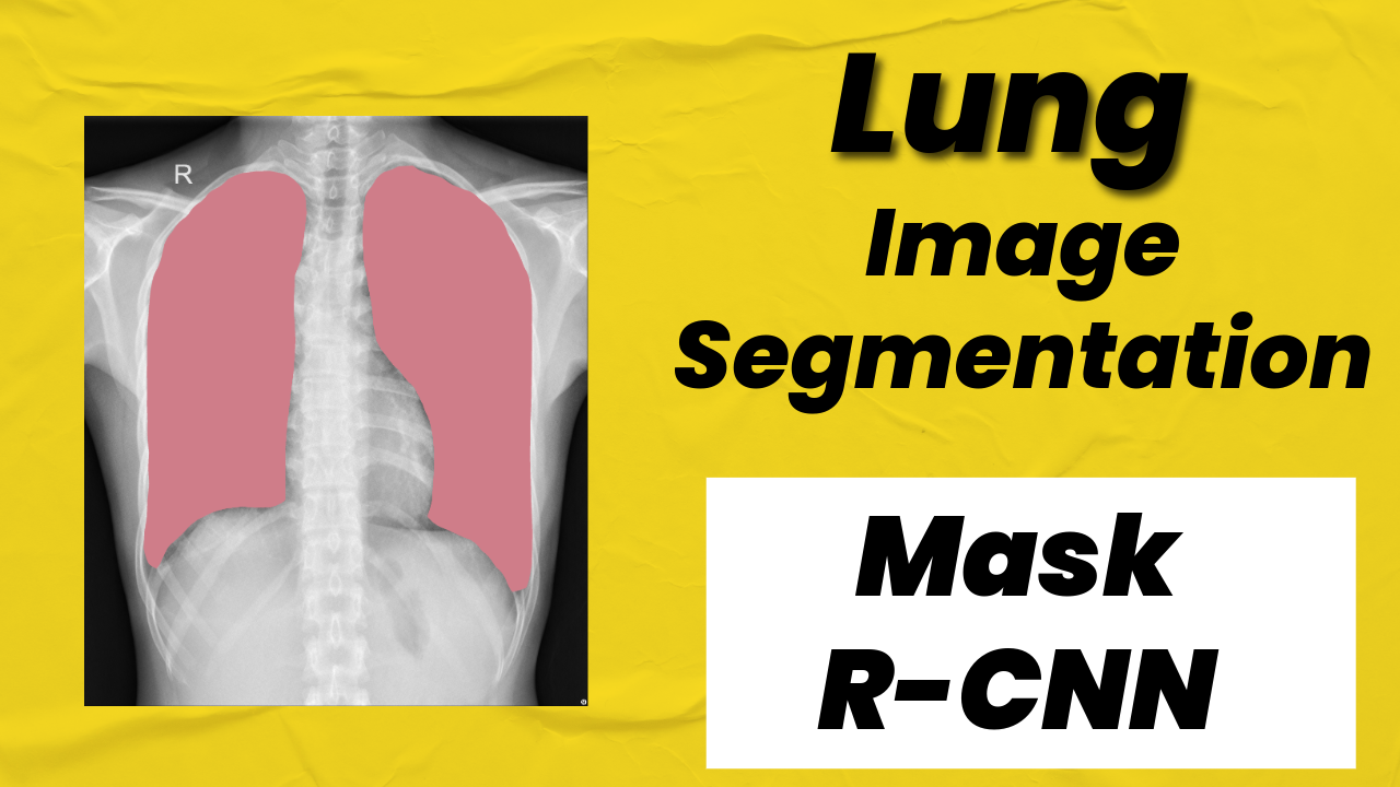How to Train Mask R‑CNN on Lung Segmentation Data