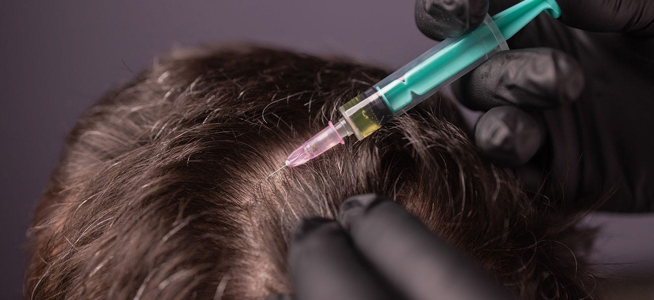 Exosome Therapy for Hair Regrowth Gurgaon