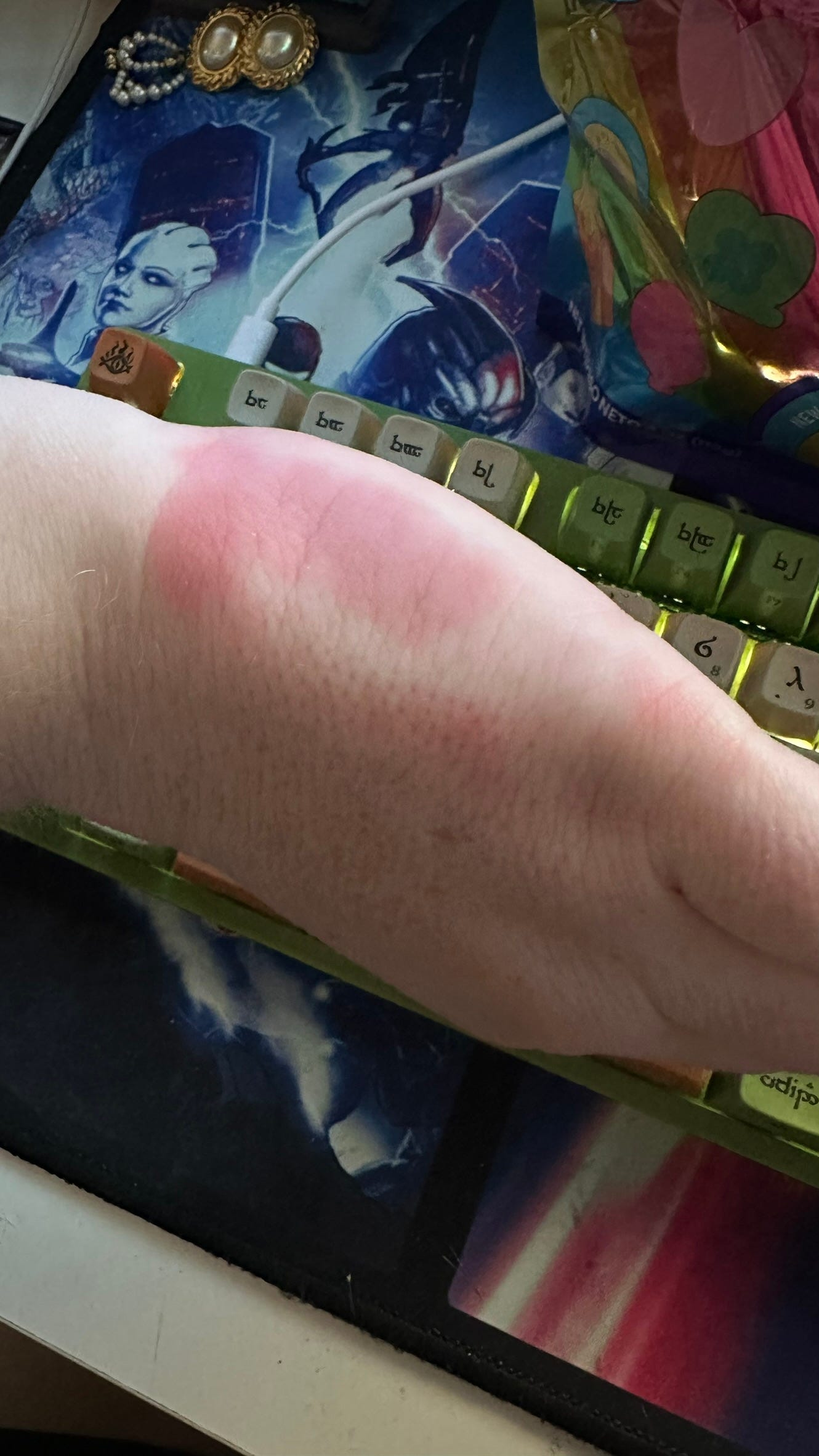 Little did I know this was just the beginning of my hand issues…