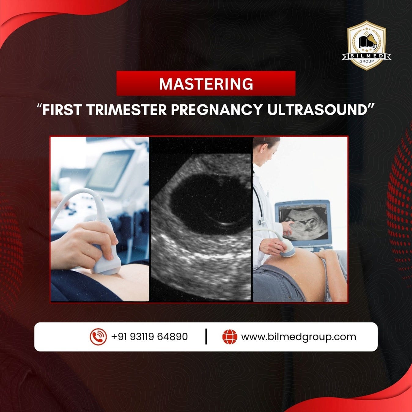 Mastering First Trimester Pregnancy Ultrasound