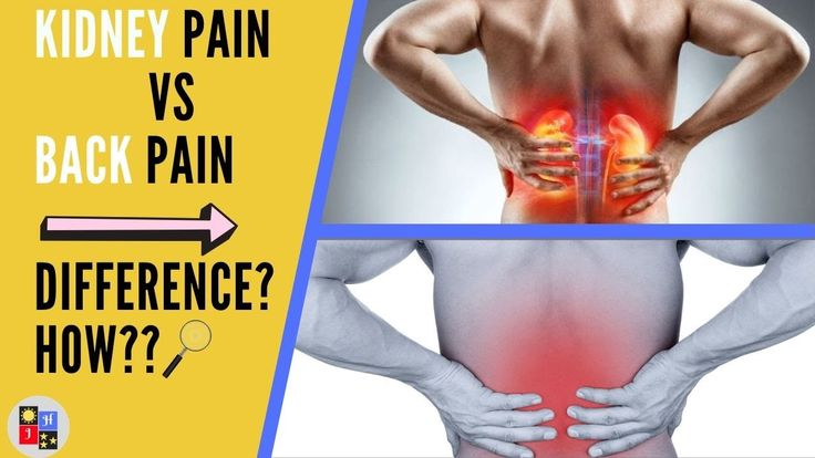 Is It Back Pain or Kidney Pain? - GoodRx