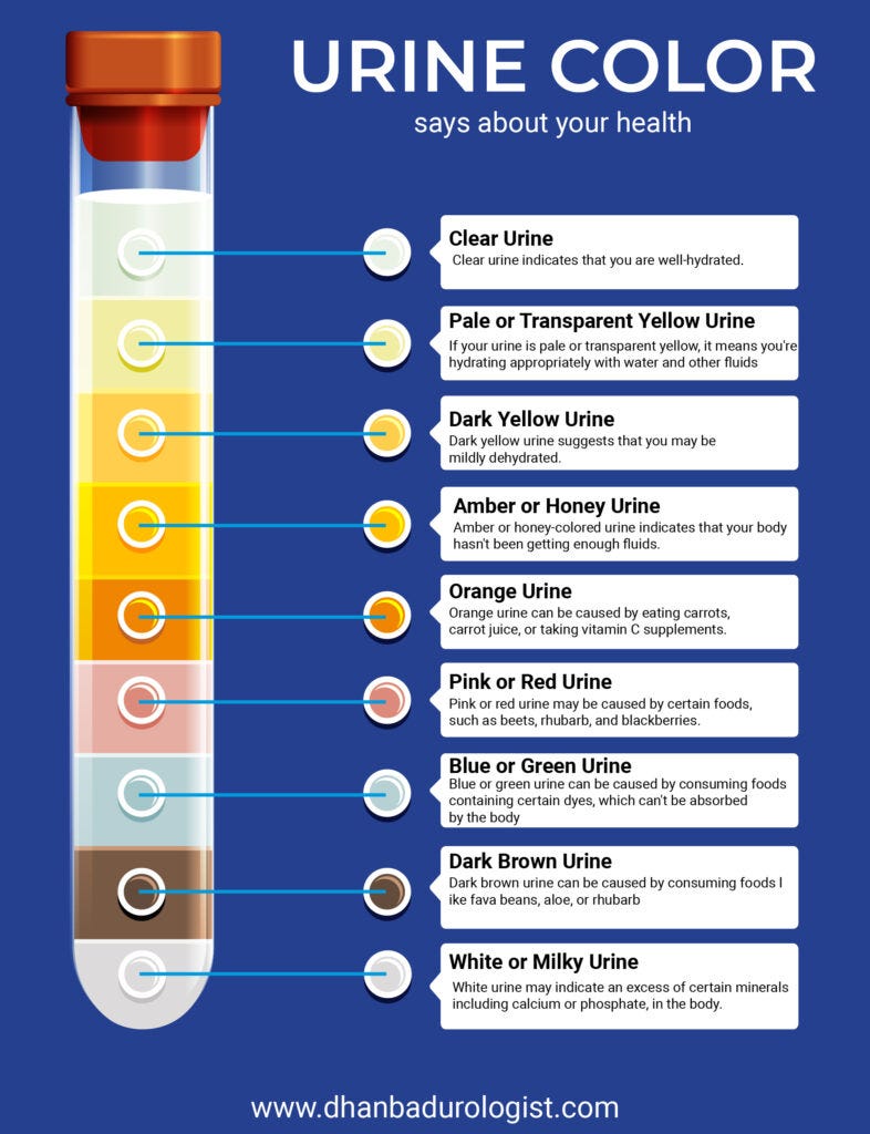 Gallstones Vs Kidney Stones Introduction Gallstones And Kidney By gallstones-vs-kidney-stones-introduction-gallstones-and-kidney-by
