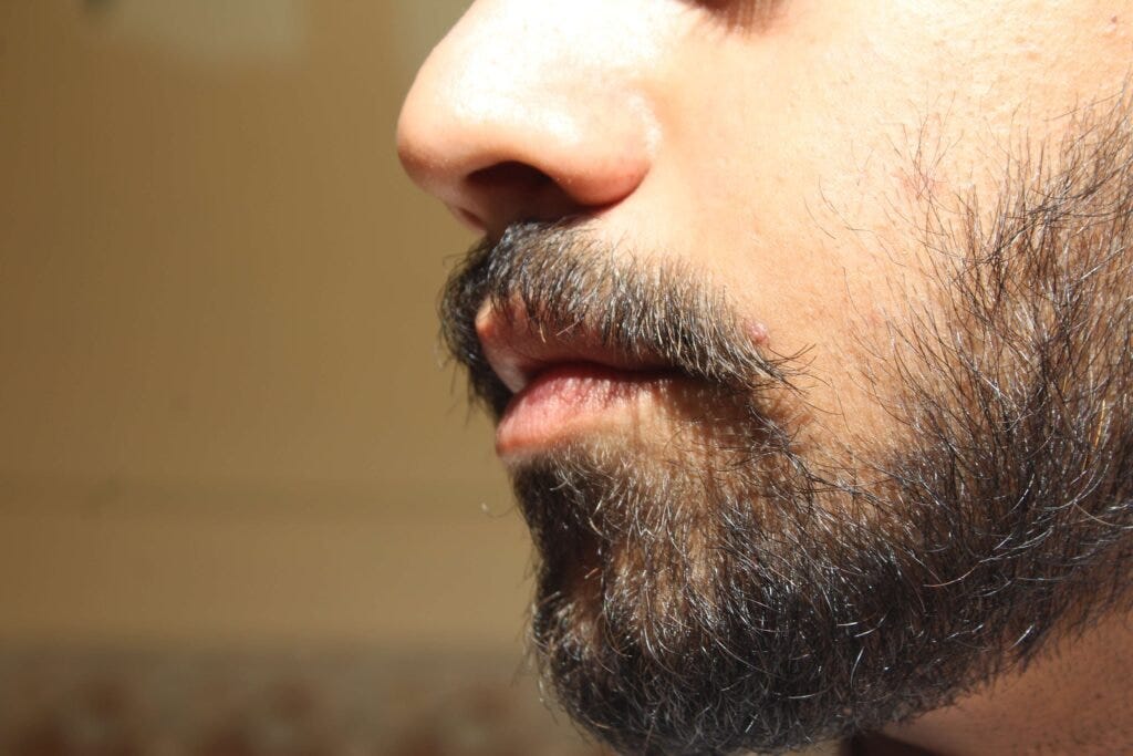 How to grow beard on cheeks. How to grow beard on cheeks 19 Tricks | by