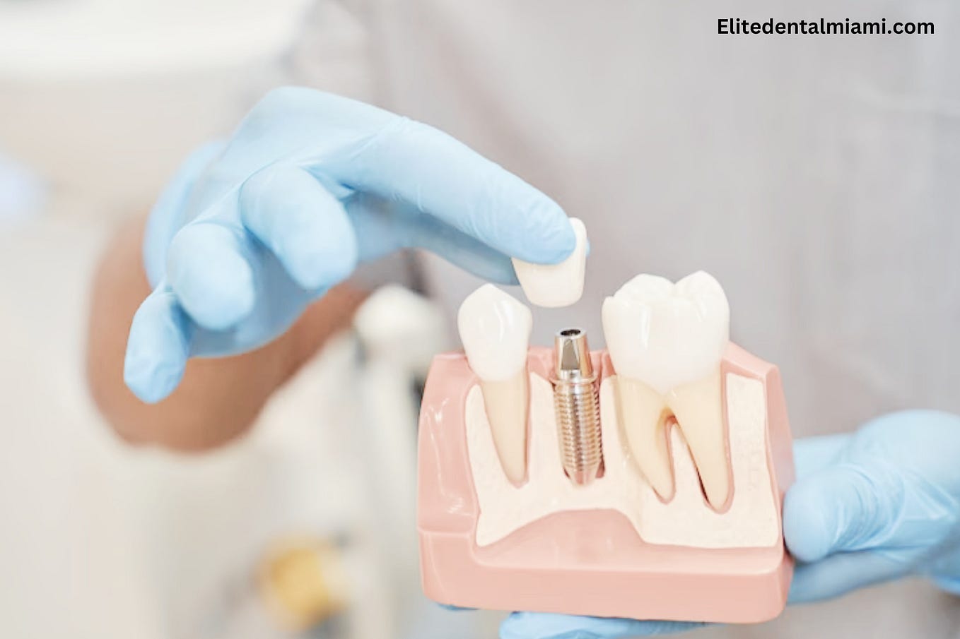 50 Soft Foods to Eat After Dental Surgery by Elitedentalmiami Medium