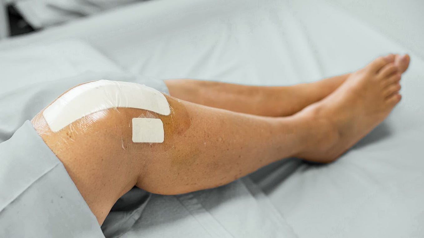 Best Knee Replacement Surgeon in Pune Knee Replacement Surgery Cost