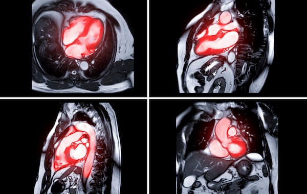 Autoencoders and Latent Space: Studying their power for data ...