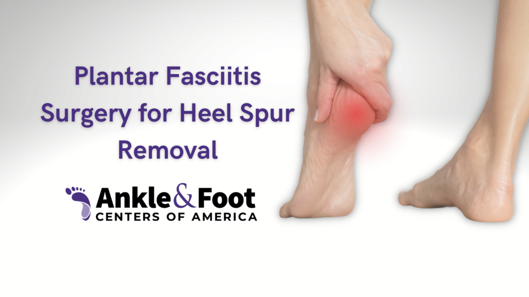 Foot Corn Removal — Bottom of Foot Callus Removal, by Ankle & Foot Centers  of America