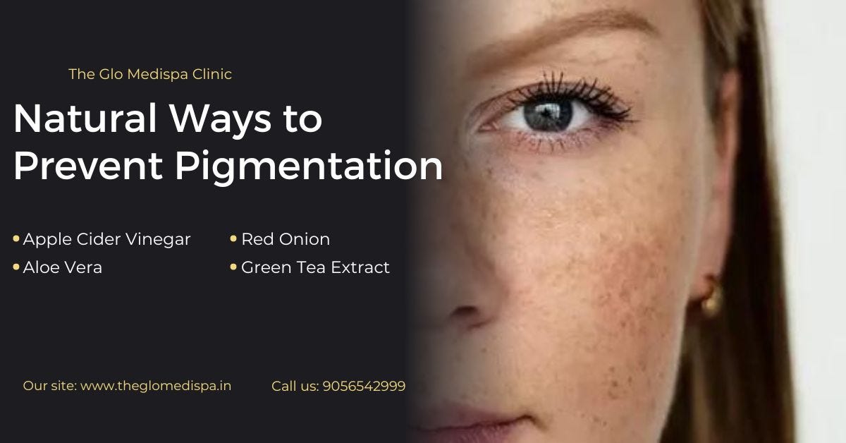 how-long-does-pigmentation-take-to-fade-away-by-the-glo-medispa