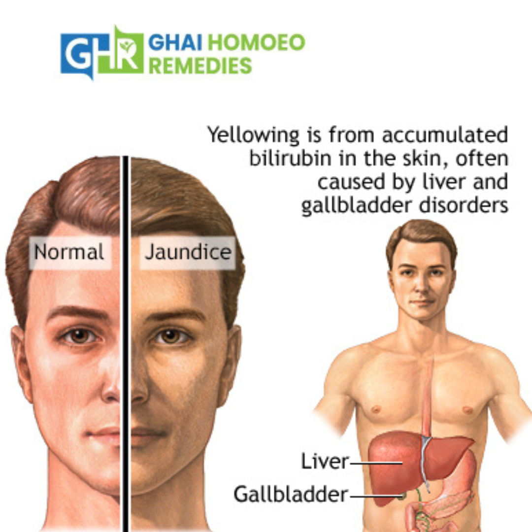 gabapentin and jaundice