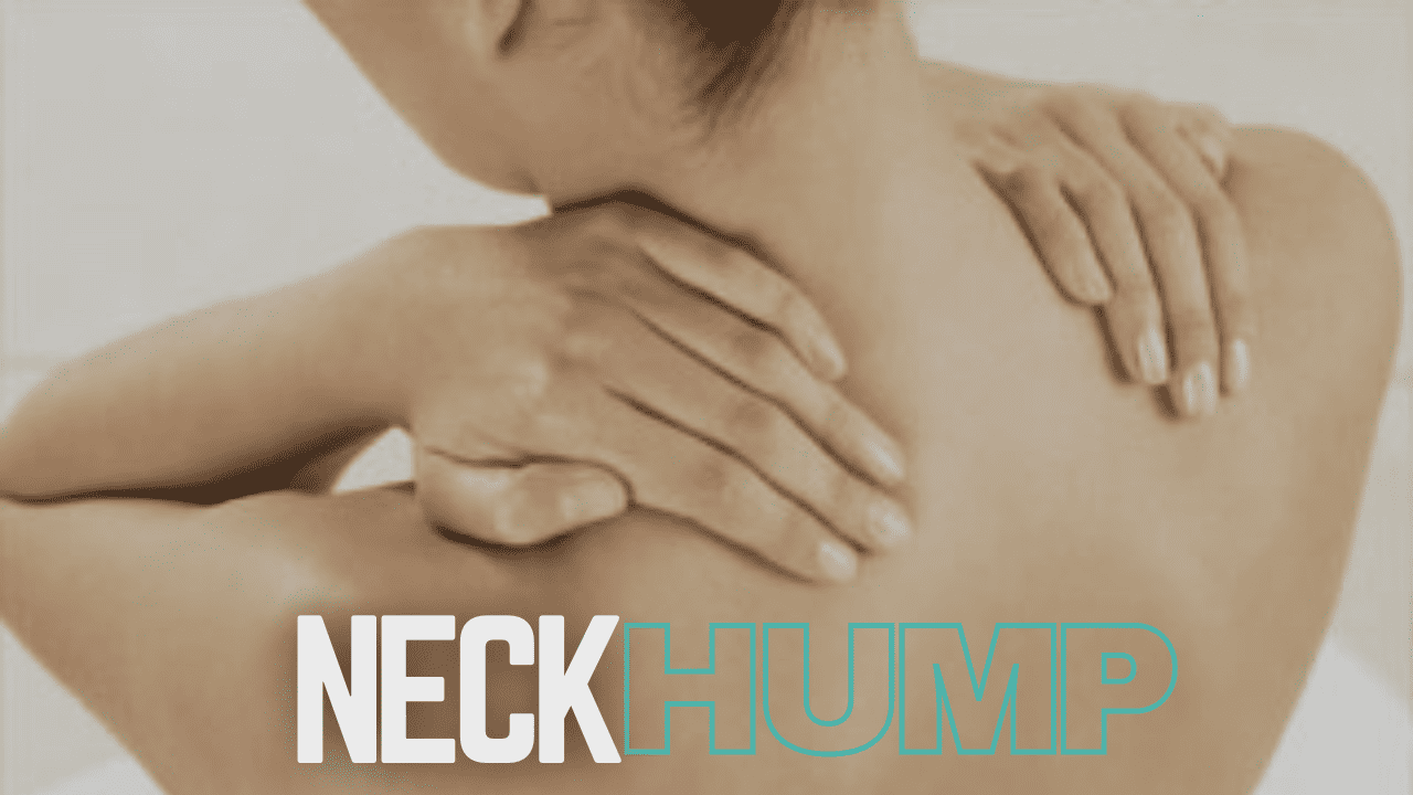 Cause of Buffalo Hump on Back of the Neck and Its Powerful Solution   Posture exercises, Neck and shoulder exercises, Better posture exercises