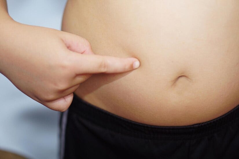 WEIGHT LOSS PROGRAM IN CHENNAI. BM Cosmetic is the leading weight loss