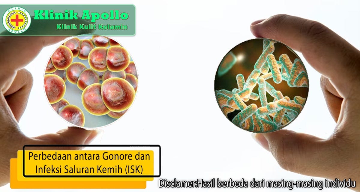 Kenali Gejala Gonore Secara Umum. Gejala gonore sebaiknya diobati sejak… by