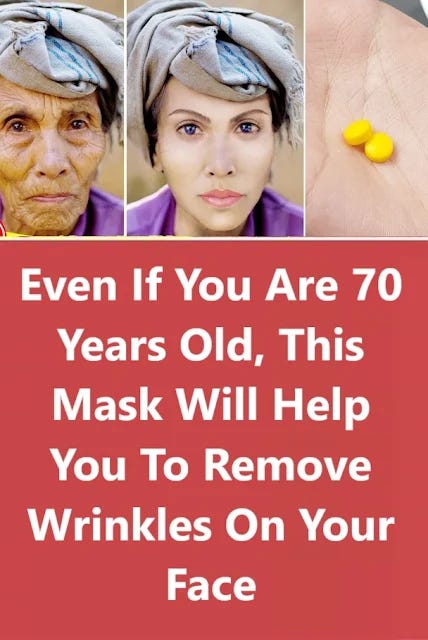 Picture of Safe and Effective Ways to Remove Deep Blackheads - Emily Blunt - Medium