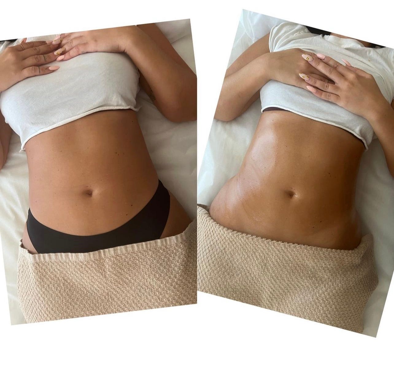 Ultrasonic Cavitation vs Laser Lipo Body Sculpting and Contouring. Which  one's better?, by Body Sculpting