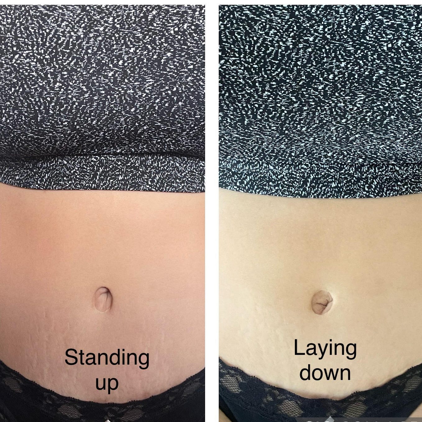 Things You Need To Know Before Getting a Helix Piercing by Piercing