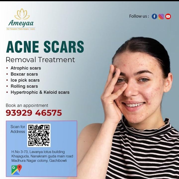 Tummy Tuck Treatment in Gachibowli Hyderabad — Ameyaa clinic AMEYAA