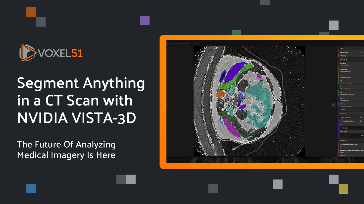 Understanding LLaVA: Large Language and Vision Assistant | by Daniel ...