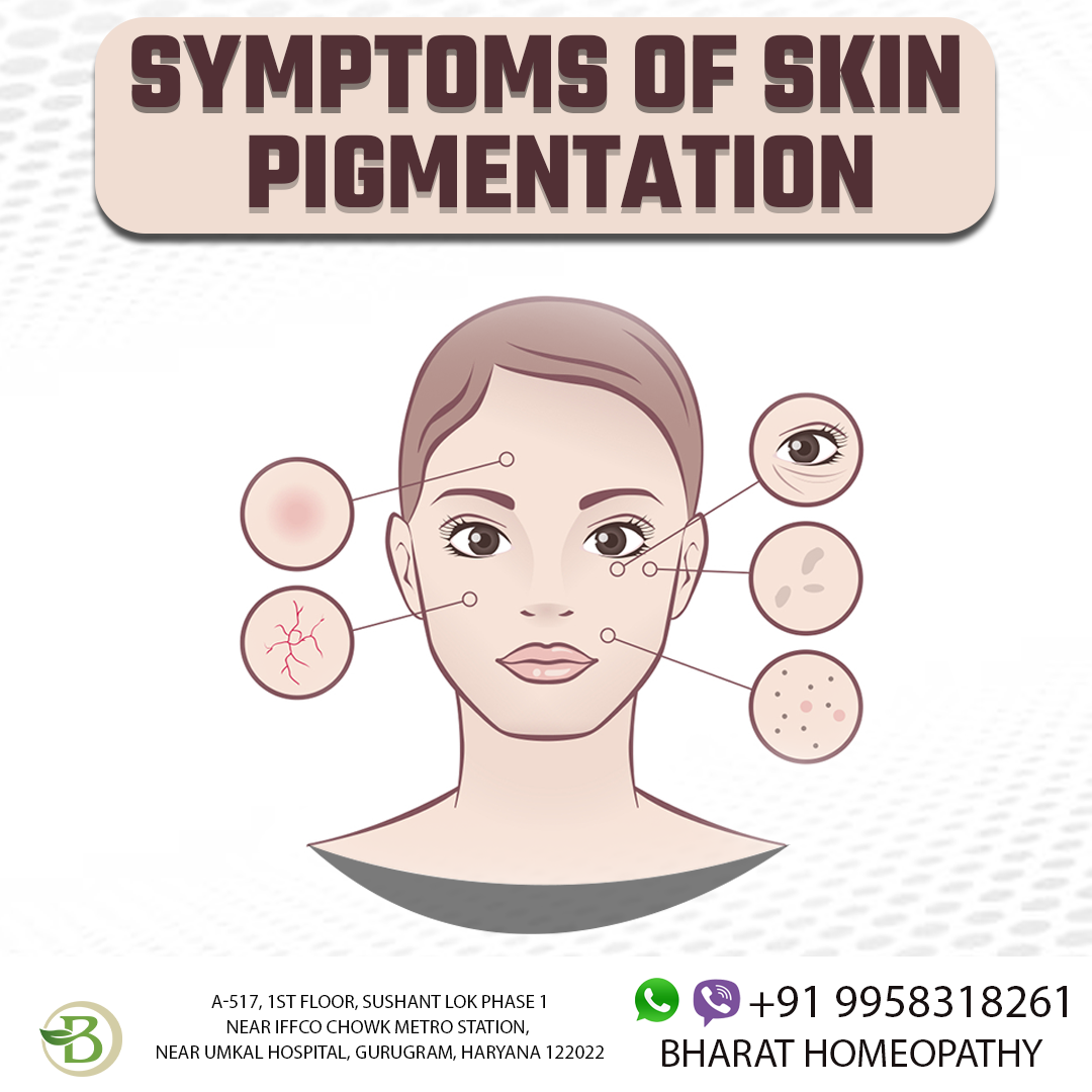 Psoriasis more than just dry skin by bharat homeopathy Jul, 2023