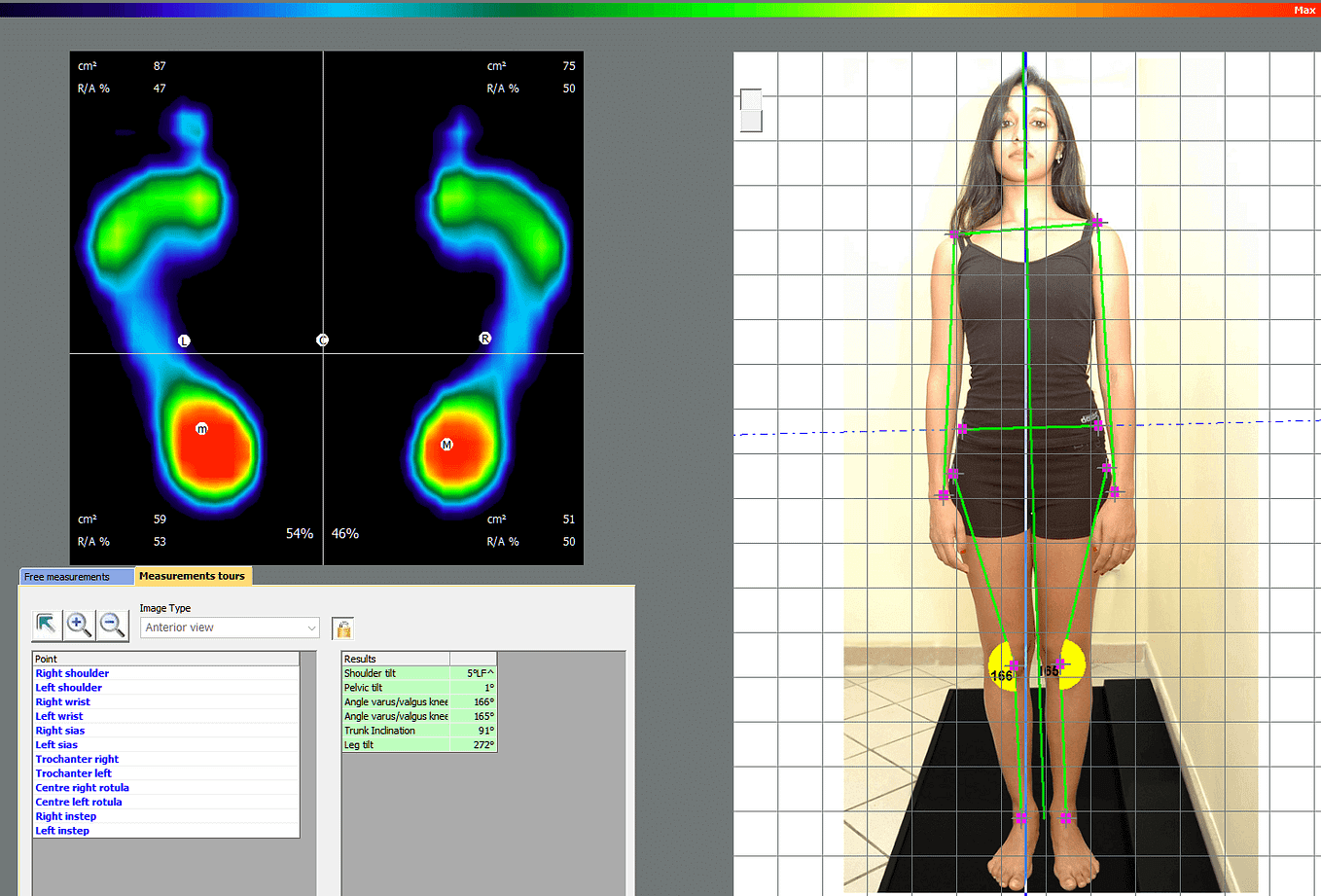 The Importance Of Orthotic CAD Cam Systems | by Sensor Medica | Medium