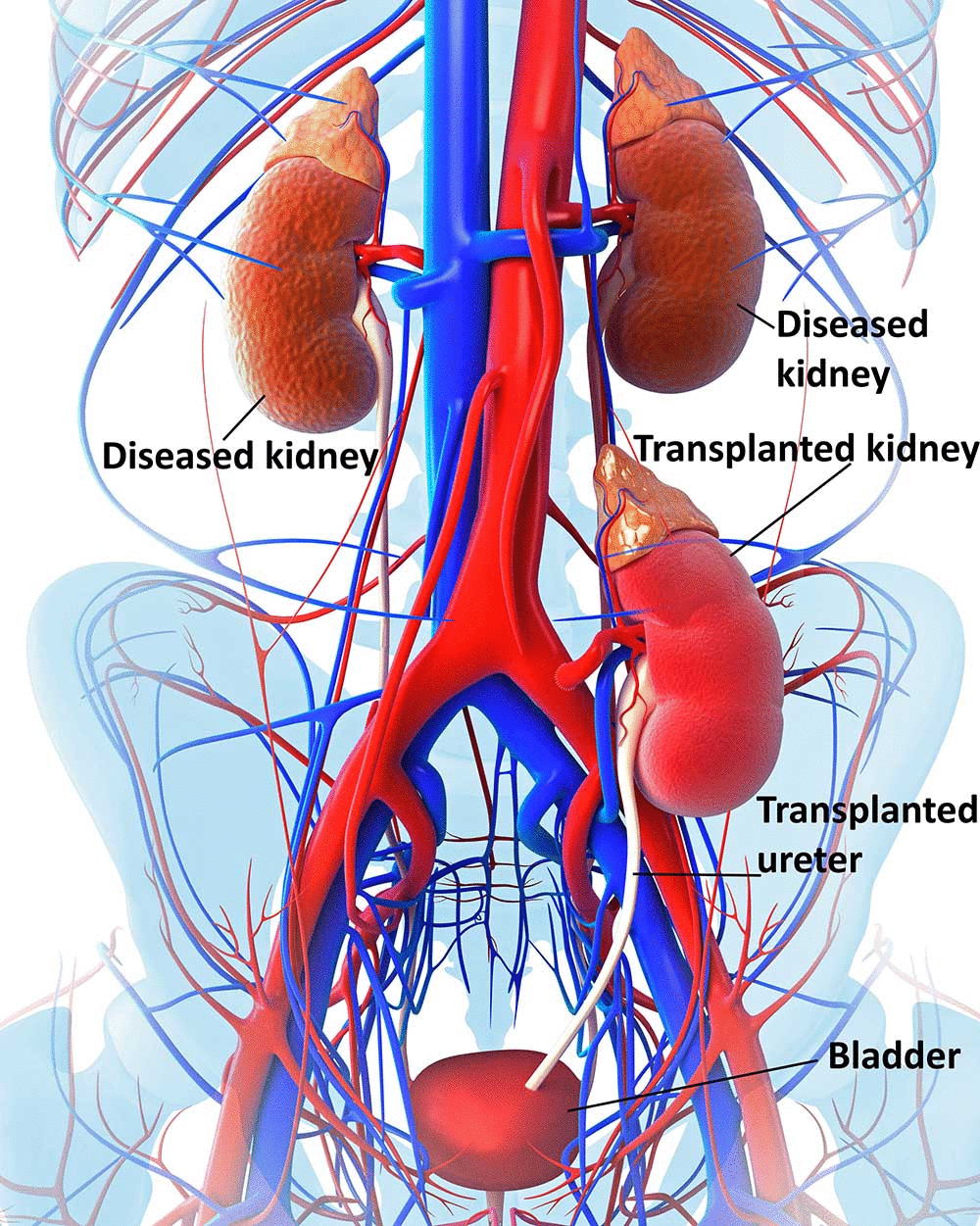 What Is Cancer Of Kidney What Are The Symptoms And Causes By Dr what-is-cancer-of-kidney-what-are-the-symptoms-and-causes-by-dr
