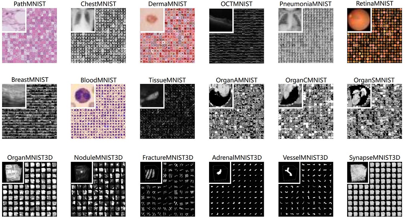 4 Advanced Methods for Texture Classification in Computer Vision (With ...