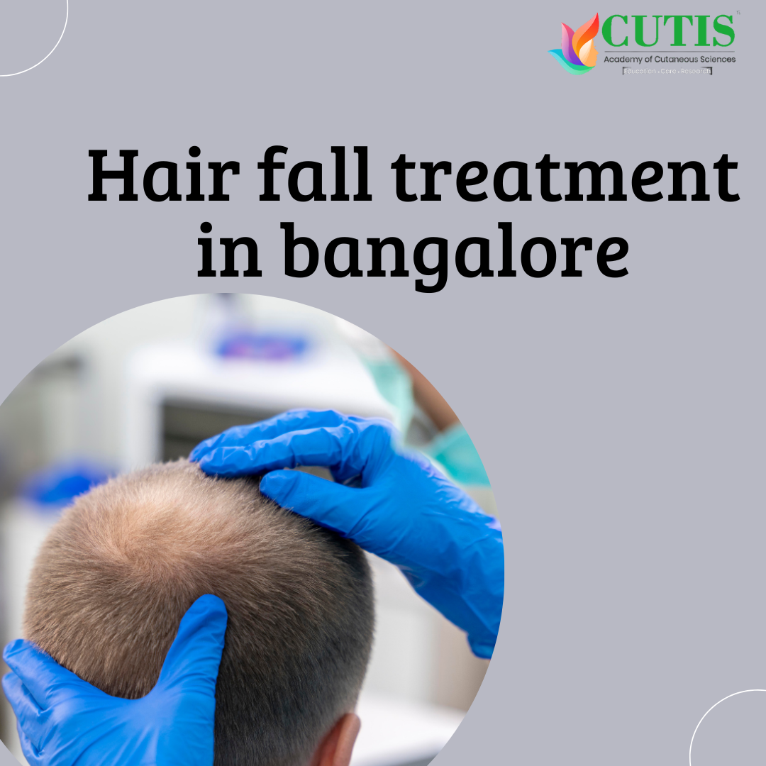 Best dermatologist for hair loss in Bangalore by shree sha Jul