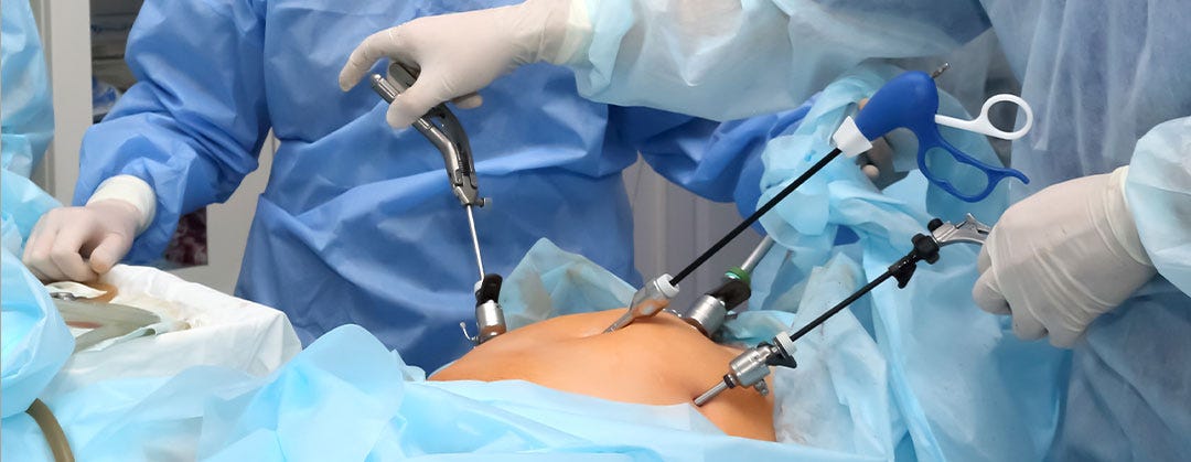 Total Laparoscopic Hysterectomy (TLH) with Incisional Hernia | by ...