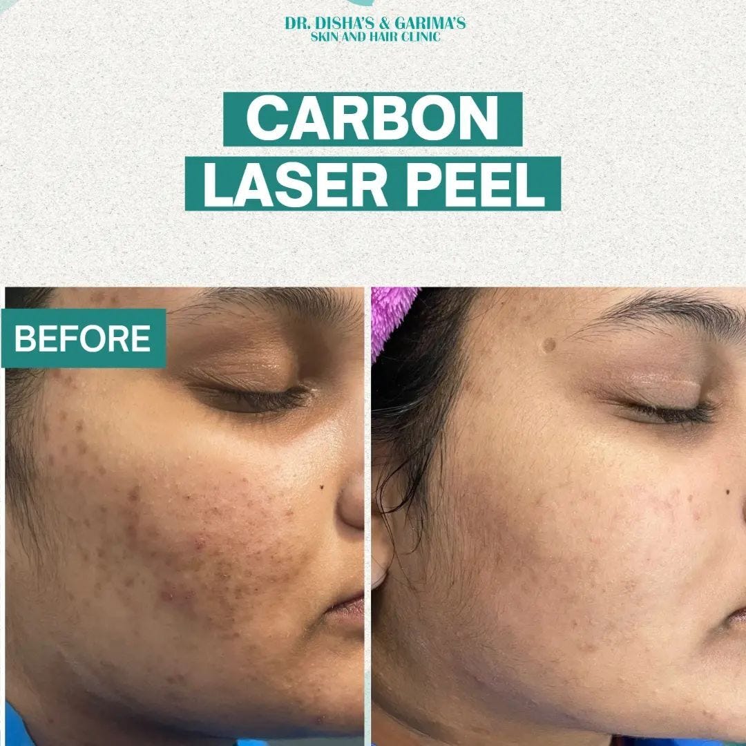 Skin Specialist in Lucknow Dr Disha’s Hair & Skin Clinic Skin