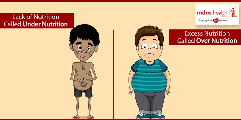 Undernutrition, Overnutrition, and Malnutrition: For many, the word ...