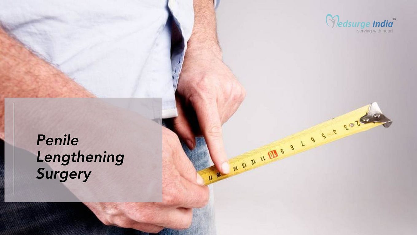 Orthopedic Treatment Cost In India Renu Rathore Medium