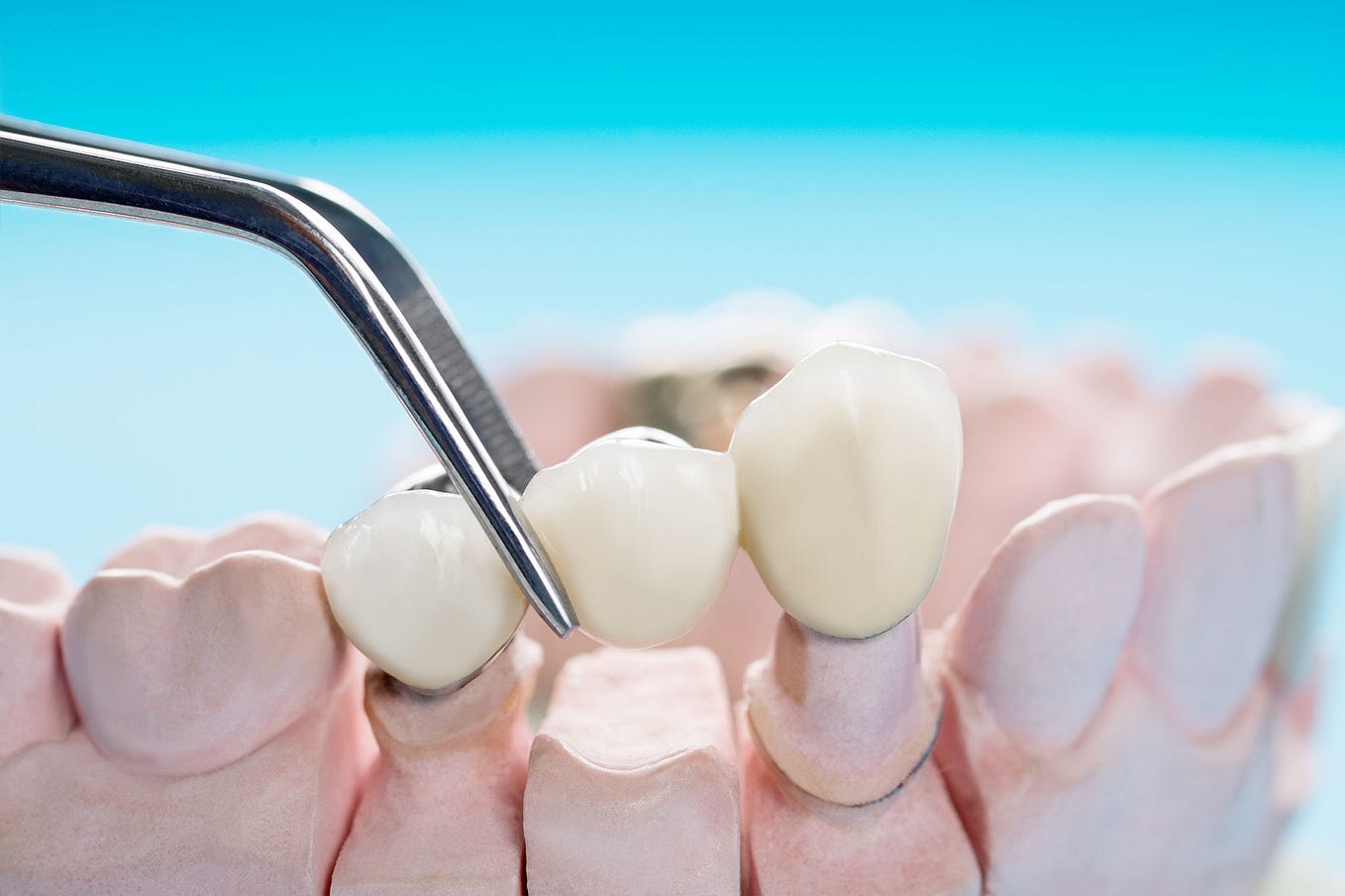 The Art of Dental Technology Your Nearest Dental Lab Solutions by