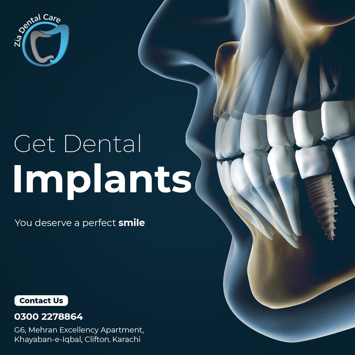 BEST DENTAL CLINIC FOR DENTAL CAVITY PROBLEMS IN KARACHI