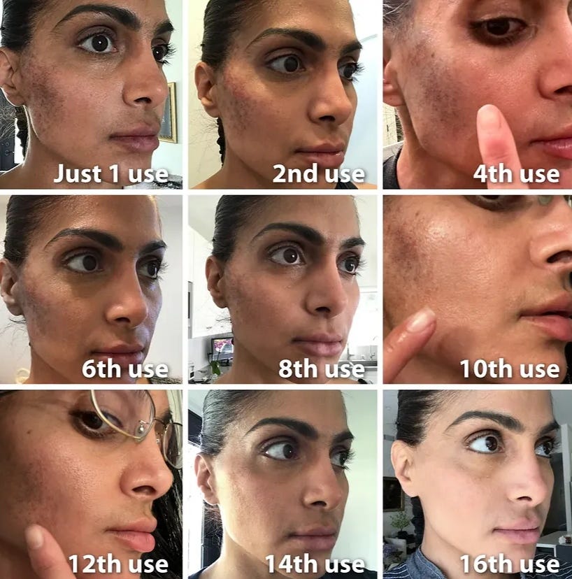 How to get rid of Wrinkles & dark spot overnight with natural remedies