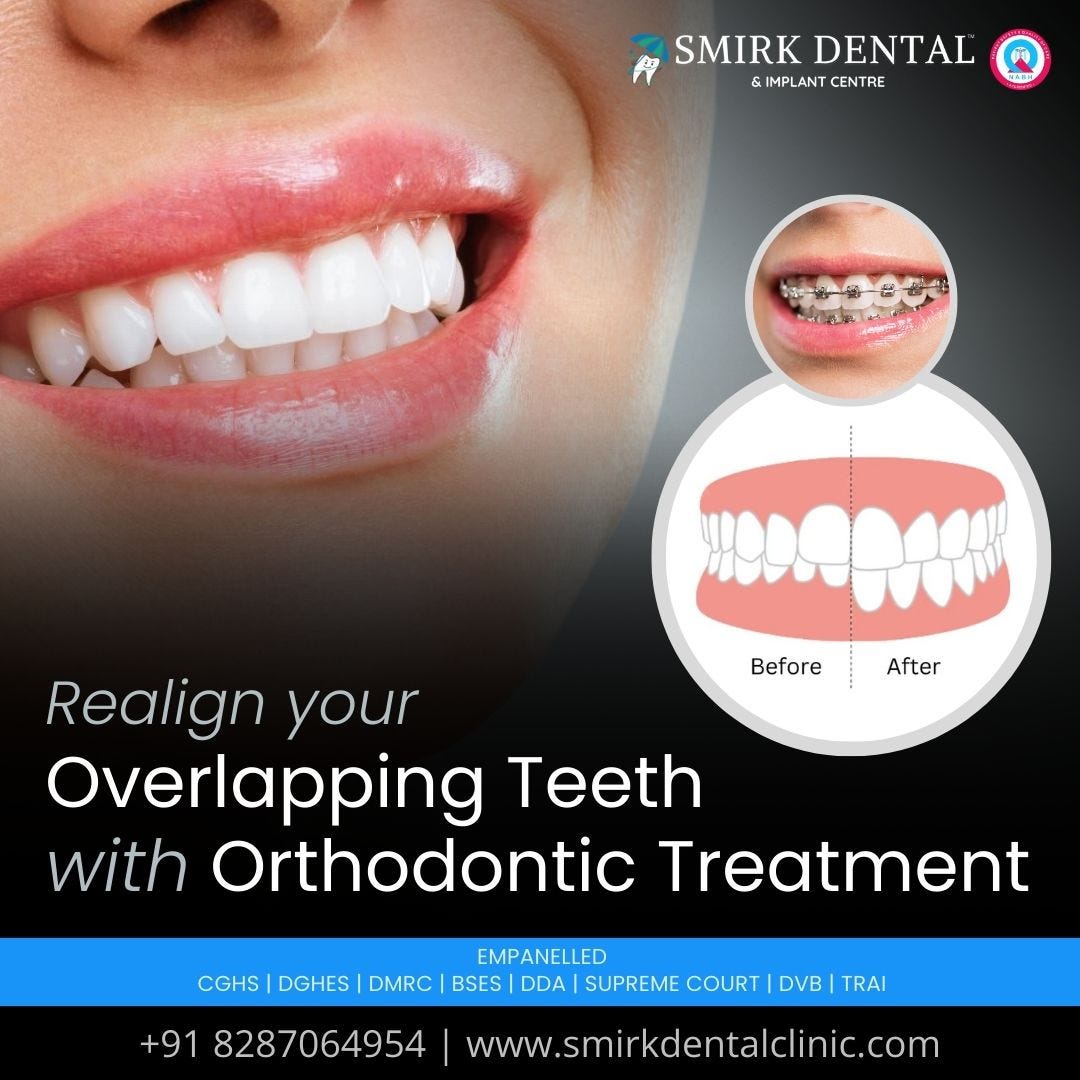 Which Clinic is Best for Dental Treatment in Delhi? by Smirk Dental