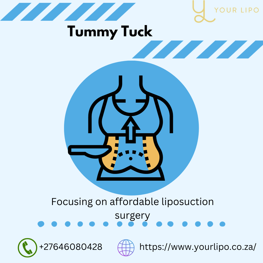 Understanding Tummy Tuck Costs in South Africa by yourlipo Apr