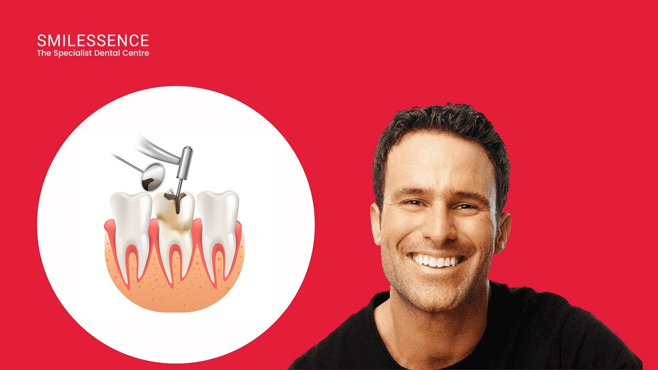 Dental Implantation Cost in Gurgaon Smilessence Medium