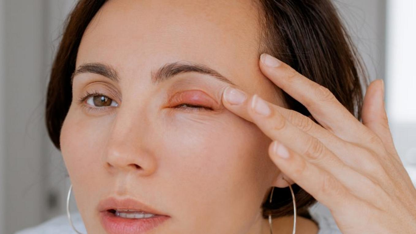 Understanding Herpetic Eye Disease | by Eyecare.live | Jul, 2024 | Medium