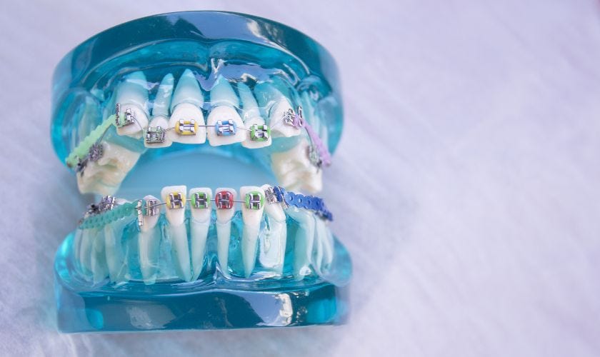 Aligning Perfection Choosing the Right Orthodontic Treatment in New