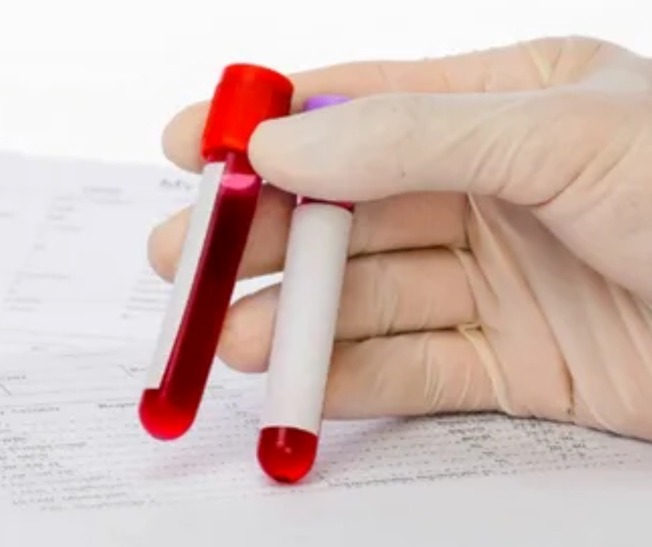 ARE YOU SEARCHING FOR PATHOLOGY LABORATORY IN PUNE? by sunrise